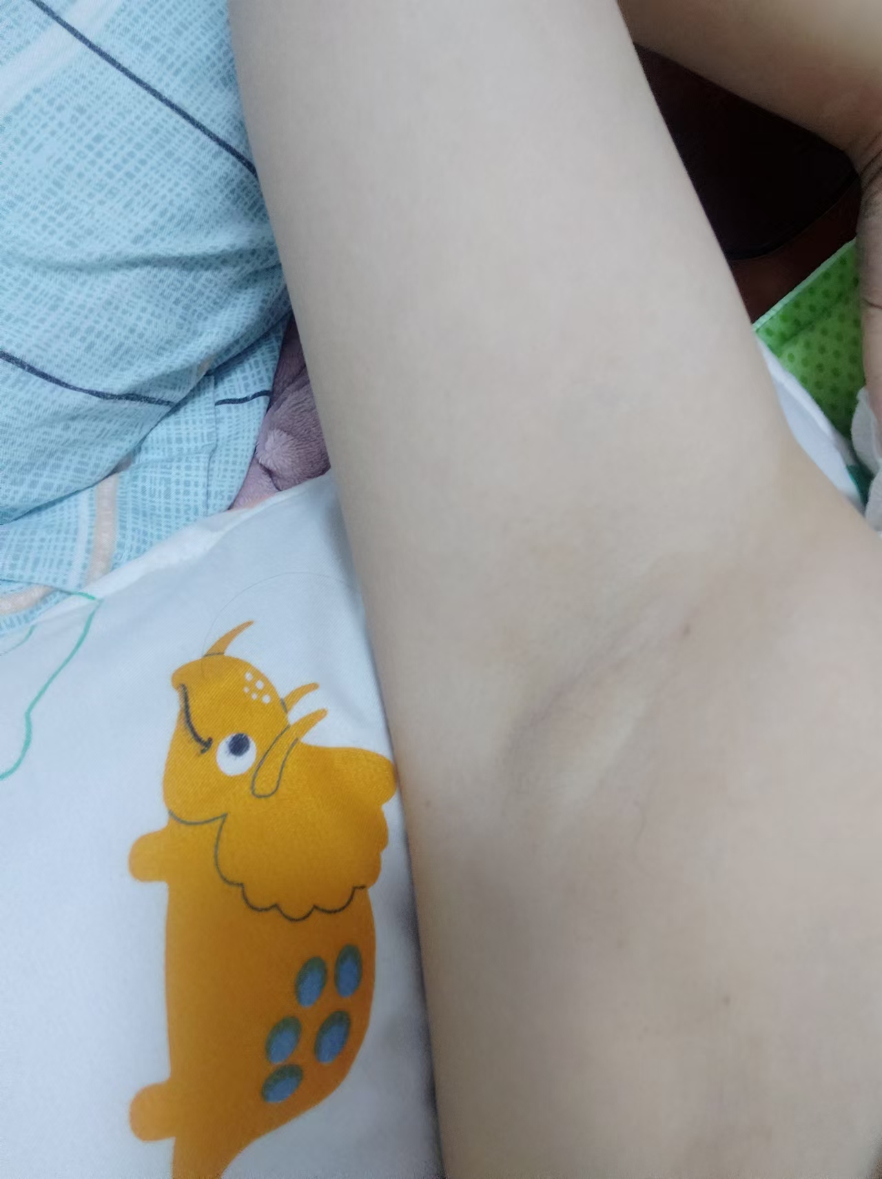 难言之隐:探索腋臭的微妙世界. 你是否害怕密闭的空间?你是否害怕爱人